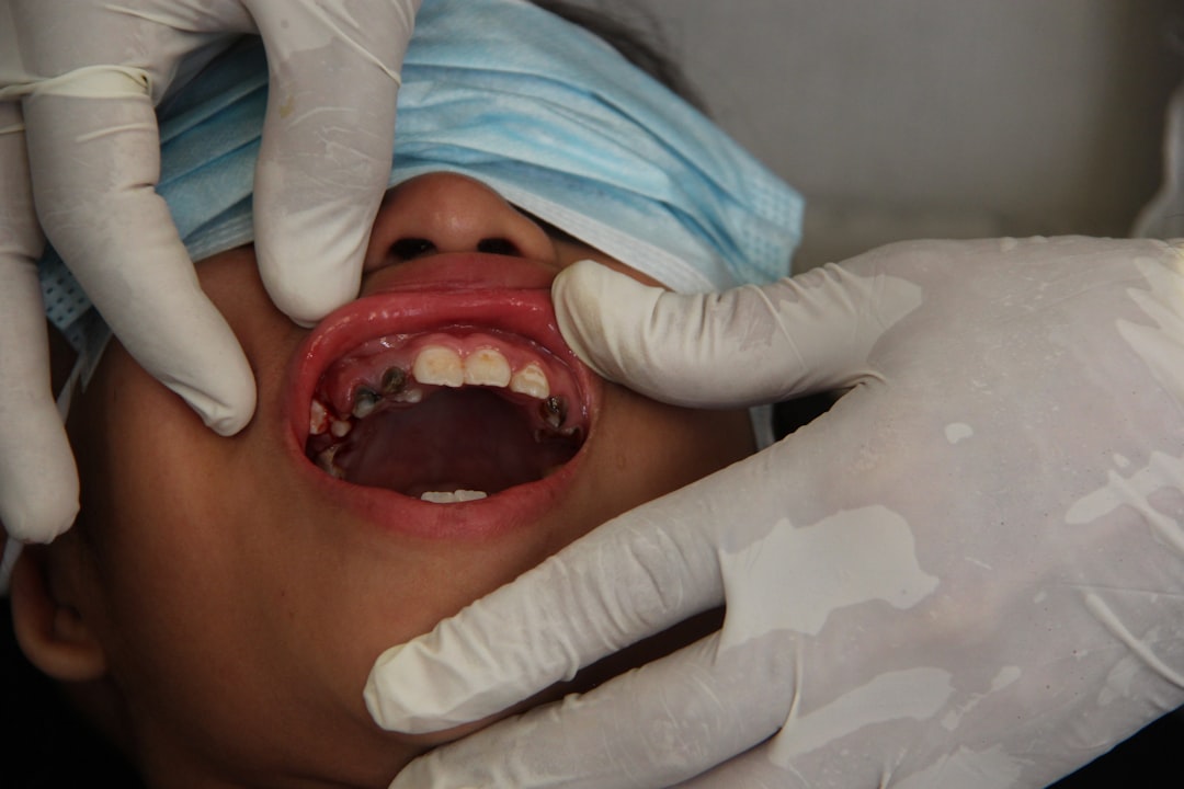 Cracked Tooth Syndrome: The Pain Your Dentist Might Be Missing