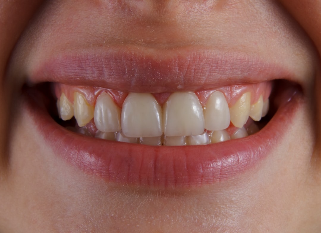 Close-up of teeth and gums showing the gumline where recession can occur