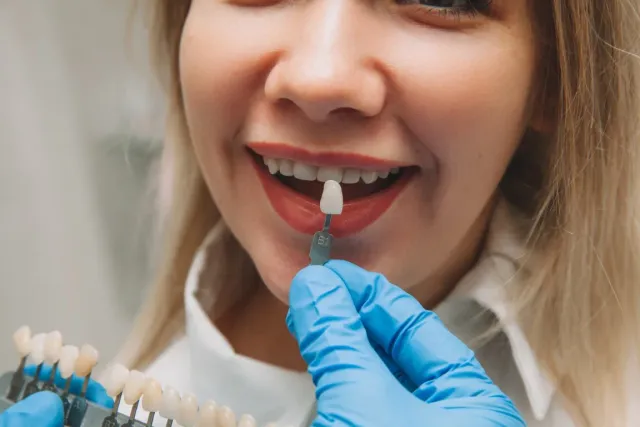 Porcelain veneer being placed on a front tooth at Peninsula Dentistry in Huntington Beach