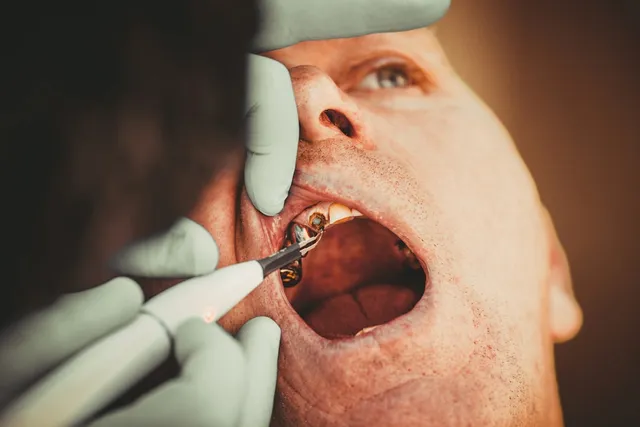 Dentist performing a thorough oral exam and cancer screening on a patient